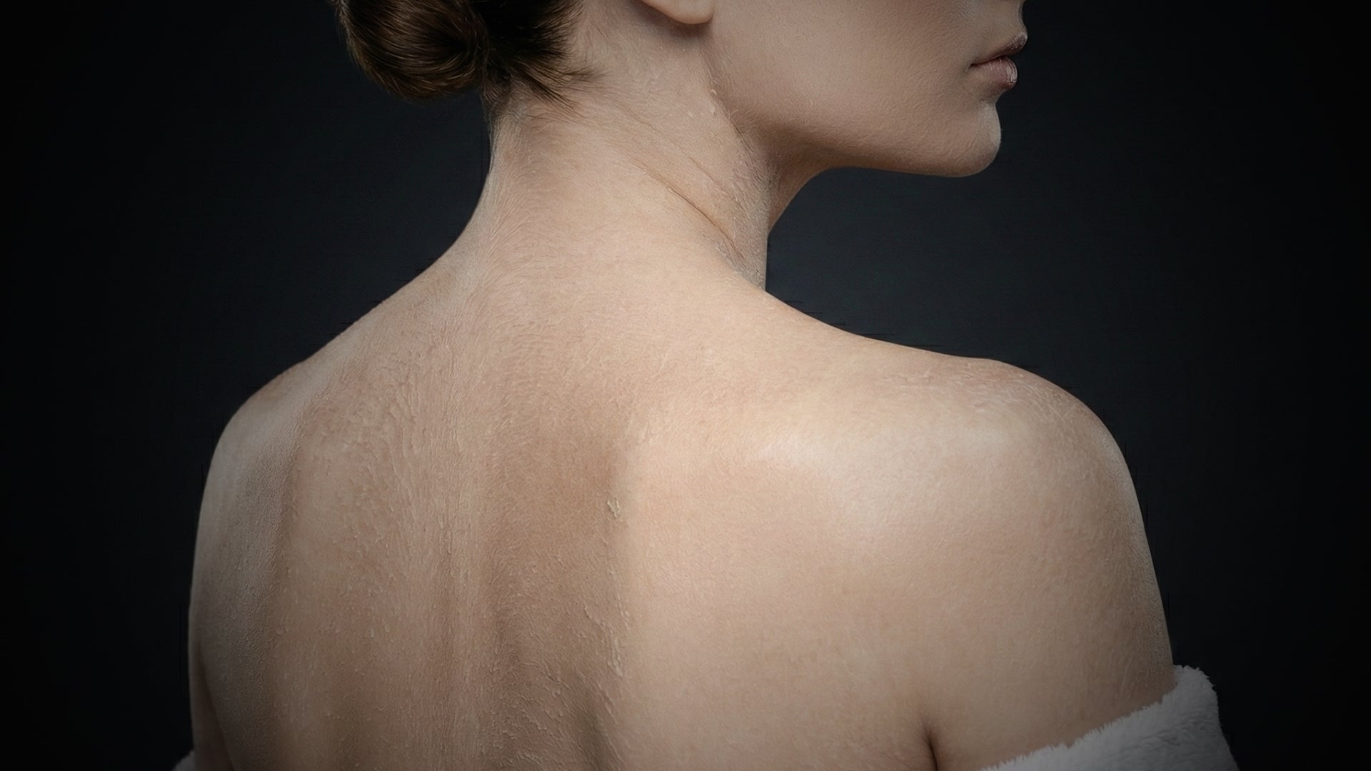 Before Velore — dehydrated skin